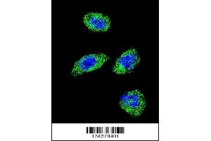anti-Polymerase (DNA Directed), gamma (POLG) (AA 1120-1148), (C-Term) antibody