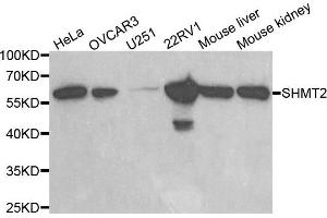 Western blot analysis of extracts of various cell lines, using SHMT2 antibody. (SHMT2 anticorps)