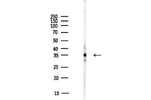 Western blot analysis of lysates from HUVEC cells(starvation,24h treatment), using DHRS7 Antibody at 1/1000 dilution.