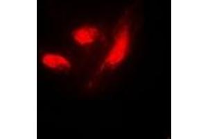Immunofluorescent analysis of IRF3 (pS385) staining in HeLa cells. (IRF3 anticorps  (C-Term, pSer385))