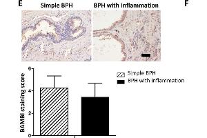 Expression of TLR4, BAMBI, p-Smad2/3 in BPH patient samples. (BAMBI anticorps  (AA 101-200))
