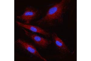 IF analysis of RPN2 using anti-RPN2 antibody (ABIN7602211).