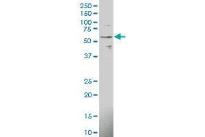 IL1R1 polyclonal antibody (A01), Lot # 050912JC01 Western Blot analysis of IL1R1 expression in HL-60 .