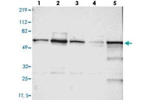 Western blot analysis of Lane 1: RT-4, Lane 2: U-251 MG, Lane 3: A-431, Lane 4: Liver, Lane 5: Tonsil with UPF3B polyclonal antibody  at 1:250-1:500 dilution. (UPF3B anticorps)