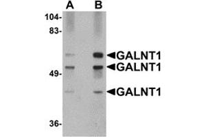 Western Blotting (WB) image for anti-UDP-N-Acetyl-alpha-D-Galactosamine:polypeptide N-Acetylgalactosaminyltransferase 10 (GalNAc-T10) (GALNT10) (N-Term) antibody (ABIN1031390) (GALNT10 anticorps  (N-Term))