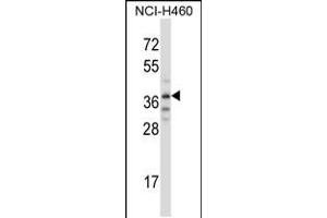 Western blot analysis in NCI-H460 cell line lysates (35ug/lane). (TRIM31 anticorps  (C-Term))