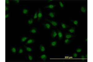 Immunofluorescence of monoclonal antibody to CLK3 on HeLa cell. (CLK3 anticorps  (AA 36-136))