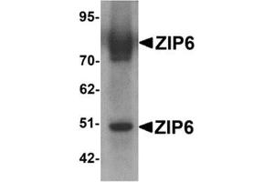 Western blot analysis of ZIP6 in mouse lung tissue lysate with ZIP6 antibody at 1 μg/ml.