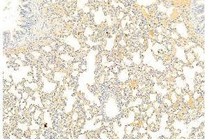 ABIN6261472 and ABIN6269092 at 1/100 staining Rat lung tissue by IHC-P. (EIF2A anticorps  (N-Term))