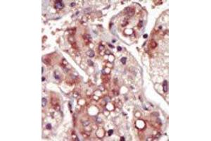 Image no. 1 for anti-Mitogen-Activated Protein Kinase Kinase 2 (MAP2K2) (Middle Region) antibody (ABIN360373) (MEK2 anticorps  (Middle Region))