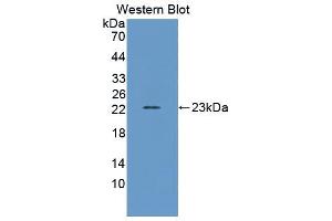 Western blot analysis of the recombinant protein. (IFNA anticorps  (AA 24-195))