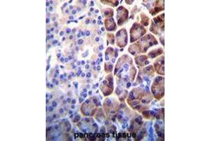 COPE Antibody (C-term) immunohistochemistry analysis in formalin fixed and paraffin embedded human pancreas tissue followed by peroxidase conjugation of the secondary antibody and DAB staining. (COPE anticorps  (C-Term))