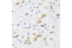 Immunohistochemistry of paraffin-embedded rat brain using LCAT antibody (ABIN5972119) at dilution of 1/100 (40x lens). (LCAT anticorps)