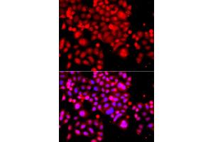 Immunofluorescence analysis of A549 cells using ASCC3 antibody (ABIN5974947). (ASCC3 anticorps)