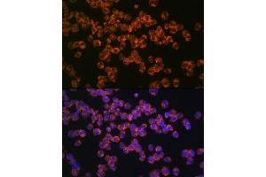 Immunofluorescence analysis of K562 cells using CD127/IL7R Rabbit mAb (ABIN7268005) at dilution of 1:100 (40x lens).