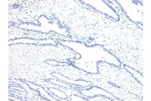 (ABIN6391406) Negative Control showing staining of paraffin embedded Human Prostate, with no primary antibody.