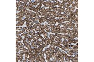 Immunohistochemical staining of human liver with ZNF629 polyclonal antibody  shows strong cytoplasmic positivity in hepatocytes at 1:50-1:200 dilution. (Zinc Finger Protein 629 (ZNF629) anticorps)