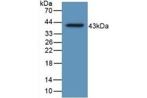 Detection of Recombinant HJV, Human using Monoclonal Antibody to Hemojuvelin (HJV) (HFE2 anticorps  (AA 29-401))