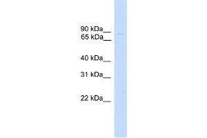 WB Suggested Anti-ZNF483 Antibody Titration:  0.
