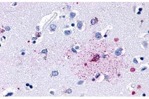 Anti-GPR139 antibody  ABIN1048722 IHC staining of human brain, neurons and glia. (GPR139 anticorps  (Cytoplasmic Domain))