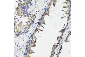 Immunohistochemistry of paraffin-embedded human prostate using OTC antibody. (OTC anticorps)