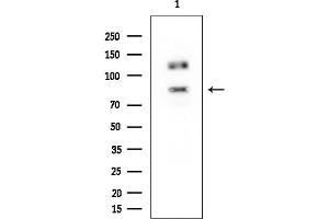 Western blot analysis of lysates from HUVEC cells, using ADAM10 Mouse Monoclonal Antibody at 1/1000 dilution.