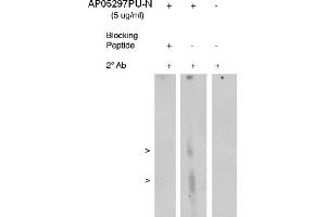 Image no. 1 for anti-Arachidonate 5-Lipoxygenase-Activating Protein (ALOX5AP) antibody (ABIN4620366) (ALOX5AP anticorps)