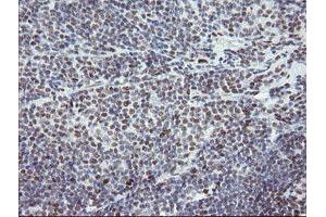 Image no. 18 for anti-Transducin-Like Enhancer of Split 1 (E(sp1) Homolog, Drosophila) (TLE1) (AA 180-460) antibody (ABIN1491049)