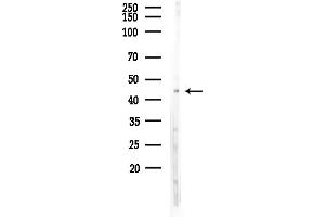 anti-DKK3 (C-Term) antibody