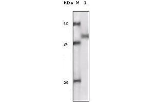Western blot analysis using RSK1 mouse mAb against truncated RSK1 recombinant protein. (RPS6KA1 anticorps)