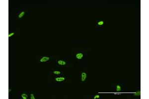 Immunofluorescence of monoclonal antibody to FUSIP1 on HeLa cell. (SRSF10 anticorps  (AA 1-100))