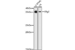 Western blot analysis of extracts of various cell lines, using Olig2 antibody (ABIN6128396, ABIN6145015, ABIN6145016 and ABIN6216575) at 1:1000 dilution.