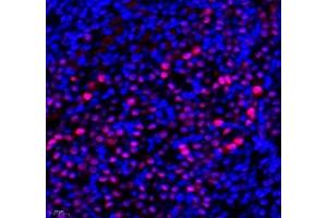 Immunofluorescence of paraffin embedded mouse kidney using Transketolase (ABIN7075978) at dilution of 1: 1100 (400x lens)