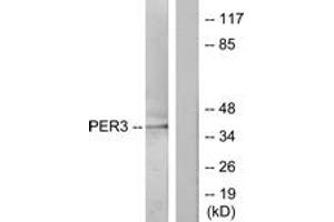 Western Blotting (WB) image for anti-Period Homolog 3 (PER3) (AA 21-70) antibody (ABIN2889525) (PER3 anticorps  (AA 21-70))