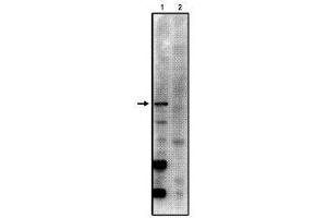 Image no. 1 for anti-Protein Phosphatase 2, Regulatory Subunit B', gamma (PPP2R5C) (AA 53-66) antibody (ABIN264946) (PPP2R5C anticorps  (AA 53-66))