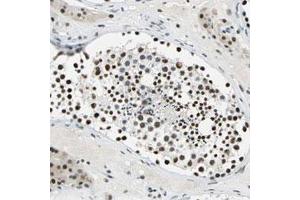 Immunohistochemical staining (Formalin-fixed paraffin-embedded sections) of human testis with MYST4 polyclonal antibody  shows strong nuclear positivity in cells in seminiferous ducts. (KAT6B anticorps)