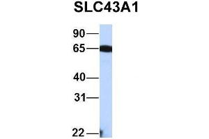 Host:  Rabbit  Target Name:  FAM46C  Sample Type:  Human Fetal Liver  Antibody Dilution:  1. (SLC43A1 anticorps  (Middle Region))