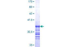 Image no. 1 for Synovial Sarcoma Translocation Gene On Chromosome 18-Like 1 (SS18L1) (AA 112-200) protein (GST tag) (ABIN1321379)