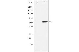 Western blot analysis of ATF2 phosphorylation expression in LOVO whole cell lysates,The lane on the left is treated with the antigen-specific peptide.