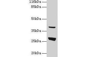 Western blot All lanes: Gamt antibody at 2 μg/mL + Rat liver tissue Secondary Goat polyclonal to rabbit IgG at 1/10000 dilution Predicted band size: 27 kDa Observed band size: 27 kDa (GAMT anticorps  (AA 1-236))
