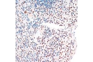Immunohistochemistry of paraffin-embedded rat spleen using TDP-43/TARDB antibody (ABIN7270731) at dilution of 1:200 (40x lens). (TARDBP anticorps  (AA 1-260))