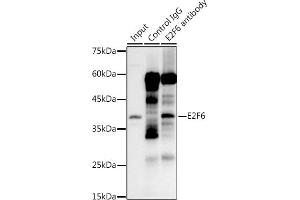 Immunoprecipitation analysis of 300 μg extracts of 293T cells using 3 μg E2F6 antibody (ABIN7266876).