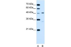WB Suggested Anti-CHST1 Antibody Titration:  1. (CHST1 anticorps  (N-Term))
