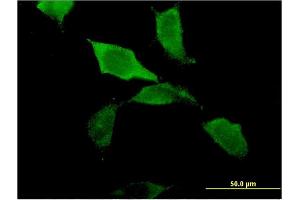 Immunofluorescence of monoclonal antibody to ZBP1 on HeLa cell.