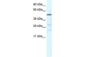 WB Suggested Anti-HSFY1 Antibody Titration:  5. (HSFY1 anticorps  (N-Term))