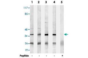 Western blot analysis of extracts from HepG2 cells (Lane 1), Jurkat cells (Lane 2), COLO cells (Lane 3) and HUVEC cells (Lane 4 and lane 5), using B3GALT1 polyclonal antibody . (B3GALT1 anticorps)