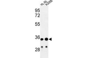 Western Blotting (WB) image for anti-Immunoglobulin Heavy Chain (IgH) antibody (ABIN2995207) (IgH anticorps)