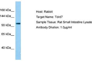 Host: RabbitTarget Name: Tdrd7Antibody Dilution: 1. (TDRD7 anticorps  (C-Term))