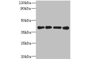 Western blot All lanes: MAGEB18 antibody at 12 μg/mL Lane 1: MCF-7 whole cell lysate Lane 2: A549 whole cell lysate Lane 3: Hela whole cell lysate Lane 4: Mouse heart tissue Secondary Goat polyclonal to rabbit IgG at 1/10000 dilution Predicted band size: 39 kDa Observed band size: 39 kDa (MAGEB18 anticorps  (AA 1-270))