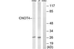 Western blot analysis of extracts from Jurkat/K562 cells, using CNOT4 Antibody.